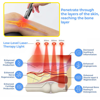 GFOUK™ MedicWave Thermal Laser Joint Care Pen