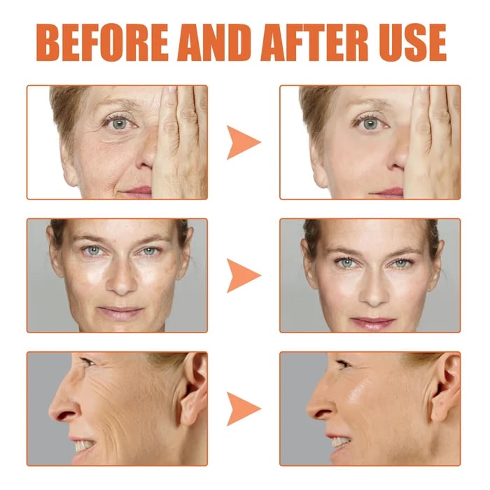 💝Last Day Promotion 70% OFF💝-Furzero™ Botox Facial Essence